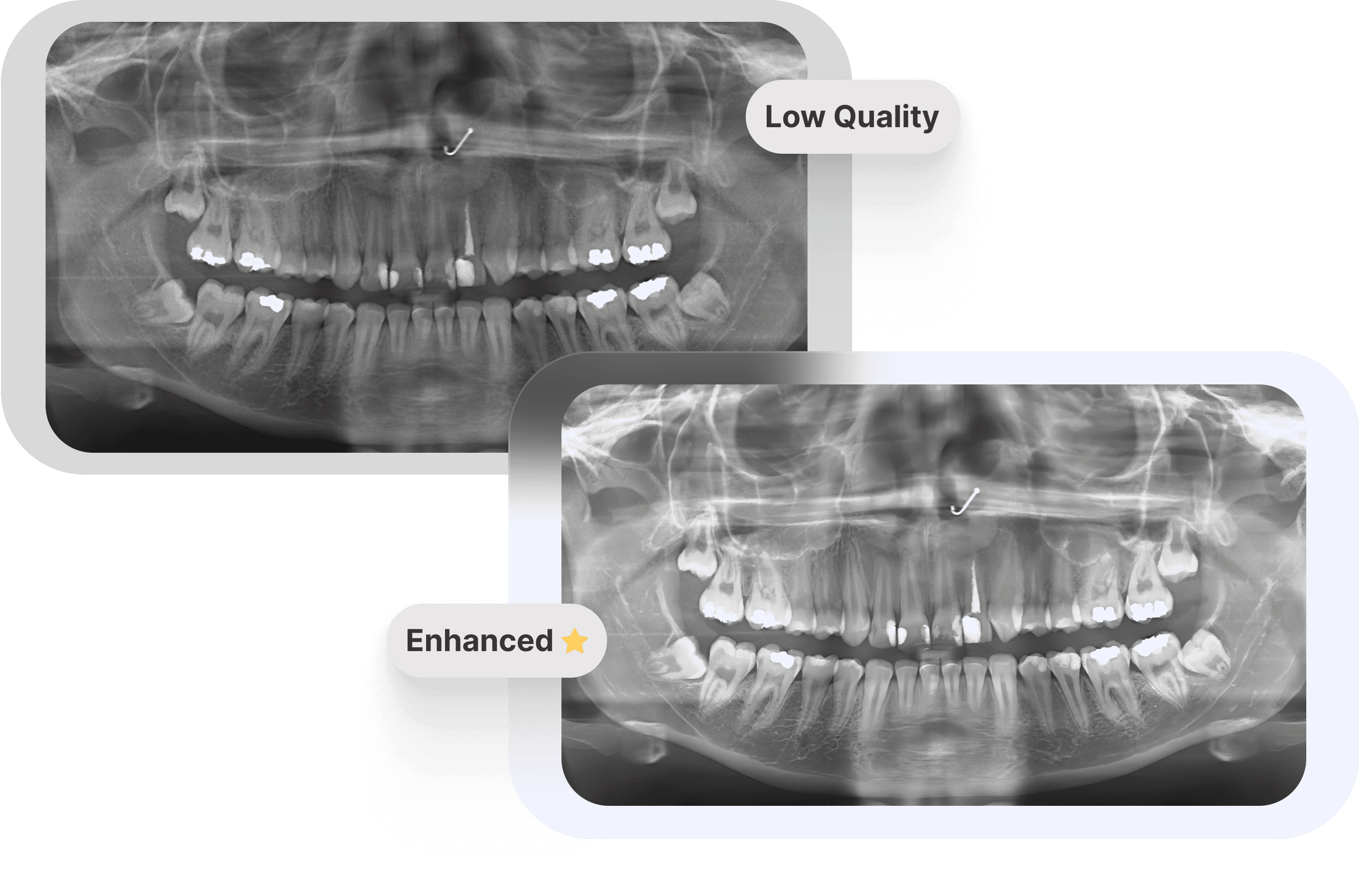 Dental X-ray Enhancement - Clearer Images, Better Diagnosis